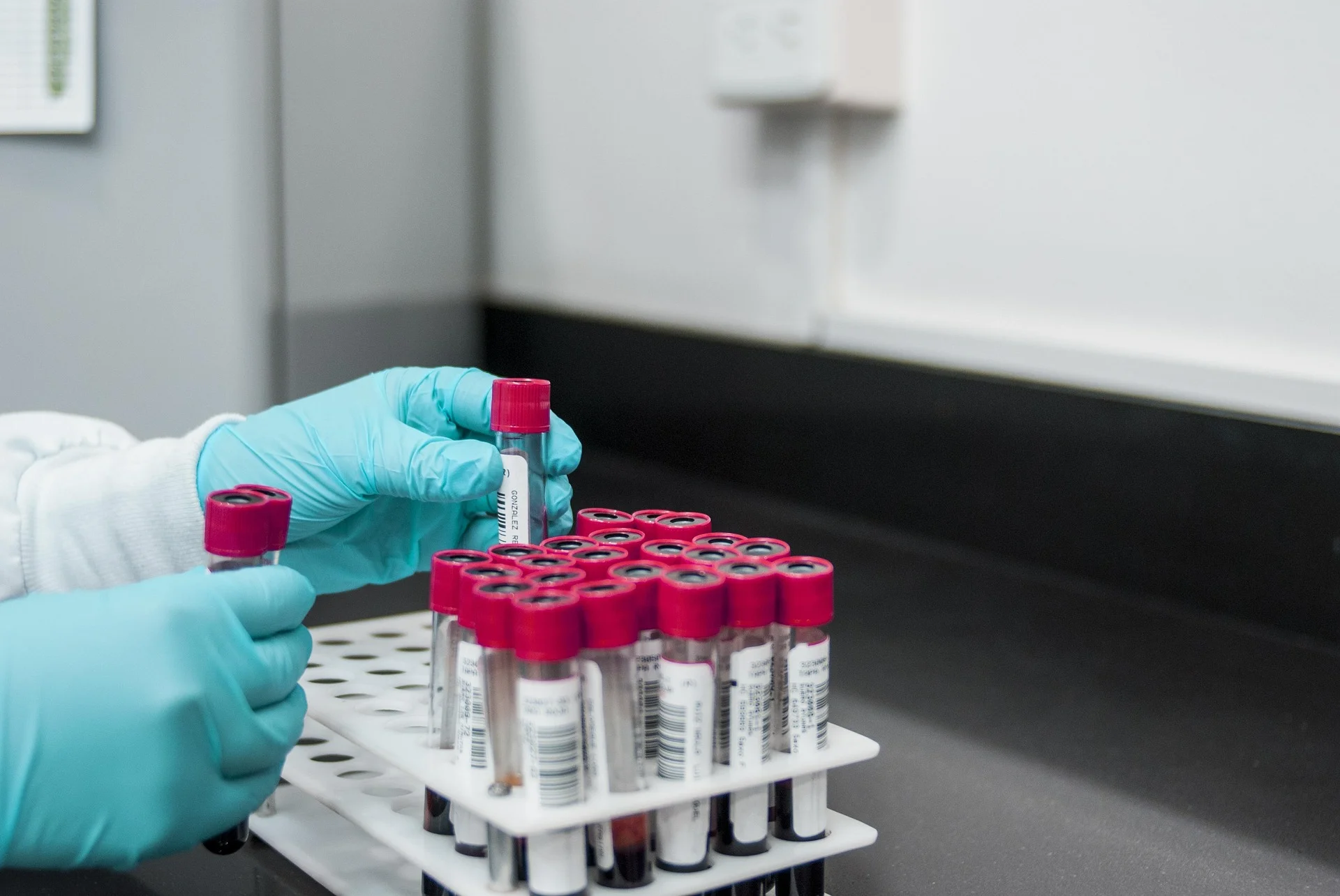 Test antidopage en athlétisme : comment ça se passe de A à Z ?